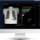 제이엘케이 이미지