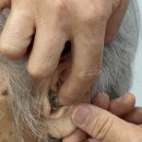 청춘보청기 이미지