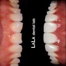 가야치과기공소 이미지