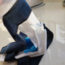 큐플린트 | 깁스가격, 발가락 깁스치료 후기3