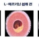 혈압 낮추기 - 적절하게 선택된 약초를 먹기만 해도 가능하다. 이미지