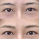 디자인조이 - 제주시 신산마을길 22-1 | 건대 군자 눈썹 디자인 조이로운 시술 직후에도 자연스러운 눈썹 컨설팅 후기