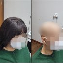 자산동198 | 대구여성항암가발 새 삶의 시작