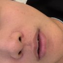 스타성형외과의원 이미지