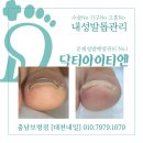 닥터아이티엔대천네일