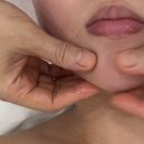 자연다움 | 상암동 디지털미디어시티역 윤곽관리 얼굴 작아지는 자연다움피부연구소 윤곽관리 후기