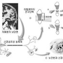 풀리지 않는 퍼즐 '치매' 이미지