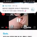 디에이픽스