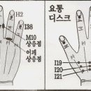 수지침 이미지