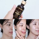 오라클코스메틱(주) | 모공수축앰플 올영세일 추천 닥터오라클 레티놀 앰플 2주 후기