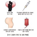 증상이 없는 [HIV 감염HIV infection, asymptomatic]감염성 질환 이미지