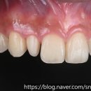 뉴티스치과기공소 이미지