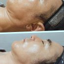 힐스템찜질테라피부천지점 | 지친 영혼을 위한 힐링 플레이스, 부천여드름관리 명가에서 찾은 내 인생의 활력소!