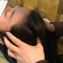 동부(창원시)건강생활지원센터 | 창원두피관리 용호동 닥터포레 두피센터 후기 창원탈모관리 추천