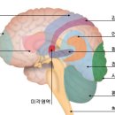 뇌실질내출혈 이미지