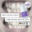 ㅠㅠ | [내돈내산] 퍼플이 치약코렉트 3개월 사용 후기 : 결론은...ㅠㅠ❌