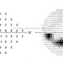 제제점빵 | [아그점빵의 눈 이야기 ] 녹내장 질환 찾아보기~