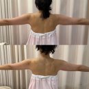 (주)씨네씨티 | [에스테틱] 통증 없이 부드러운 팔뚝관리, 원주웨딩관리 미레브 라인업케어 후기
