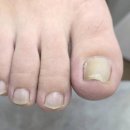 레푸스감삼점&에이레네