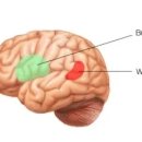 실어증[aphasia] 이미지