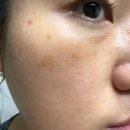 로덱스코리아 | 로덱스화장품 사용후기/미백 모공 잡티에 효과최고예요