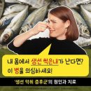 생선악취증후군의 원인과치료 이미지