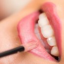 스마트하루치과의원 이미지