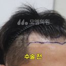 오던모발