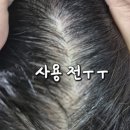 두피케어/홈케어/스켈프 스케일러/내돈내산후기/덕천동미용실/구구헤어