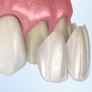연세참예쁜치과교정과치과의원 이미지