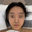 현리주유소 | [범계/안양 피부관리] 1:1 맞춤케어 스킨리벨럽 프리미엄 에스테틱 후기 효과는? (구 스킨리벨럽)