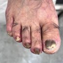 문제성 손, 발 오감네일 | <문제성 손,발 오감네일 도화점>에서 만난 특별한 관리 후기:)!!