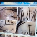 덕영빌딩 | 대구 문제성 두피관리 잘하는 곳 동성로 비텐에스테틱 본점 솔직후기