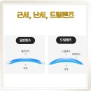 난시, 근시, 드림렌즈에 대한 이야기