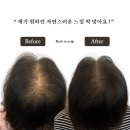 블랙인스칼프 | 대구두피문신 만족스러웠던 경험