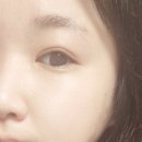 디어달