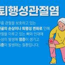 퇴행성 관절염 이미지