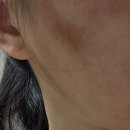 블랙핑고 | 대구리프팅 효과 제대로 본 곳! 블랙핑고 대구본점 프리미엄 플라모드 후기