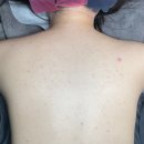 세븐일레븐대구경대교점 | 대구웨딩관리 반월당등드름 필링 케어 후기 ‘솔에스테틱’