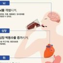 커피 많이 마시면 설사 두통 커피 부작용 이미지