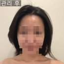 소문난샵 | (광대 즉각 효과) 수원 가성비 경락 맛집 소문난 피부샵