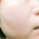 아이앤비팜 | 제이슨오일/ 페이스오일 추천 비타민E오일 5000IU