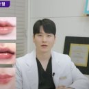 자연미한뱡병원 | 입술필러 유명한곳 : 많이 넣으면 예쁘다?