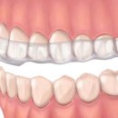 덴탈에이치과기공소 이미지