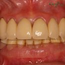 선 치과기공소 이미지