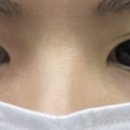 리트머스성형외과