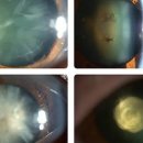 아이예쁜안경 이미지