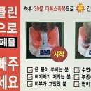 리얼클린족욕 이미지