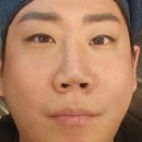 리엔장의원 | 리엔장의원 목동점 인모드 FX 포마 풀페이스 시술후기