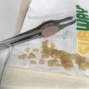 두얼의원 | 피부과 후기 (1) | Co2 비립종, 편평 사마귀 무제한 제거, 경과 후기 (라르떼의원)